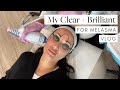 My Clear + Brilliant Laser Treatment for Melasma with Dr. Nina Desai! | Susan Yara