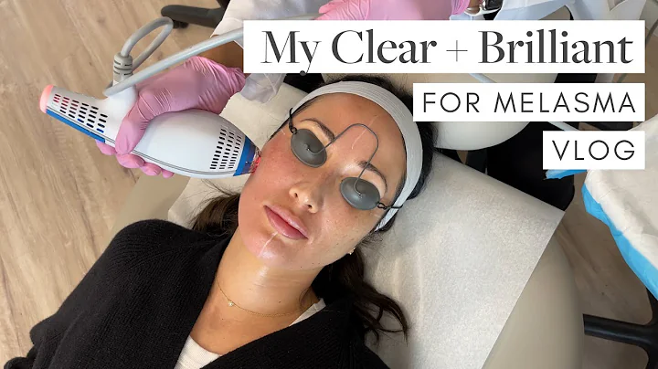 My Clear + Brilliant Laser Treatment for Melasma w...