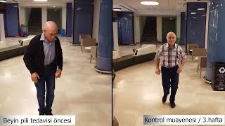 Parkinson hastası Şaban Kırtay'ın Beyin Pili ile Değişimi | Doç. Dr. Ali ZIRH