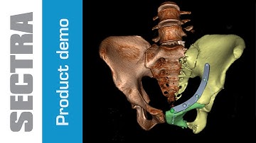 Sectra 3D Trauma Pelvic