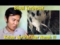 Reaksi Melihat Bisul Terbesar dengan Nanah Terbanyak