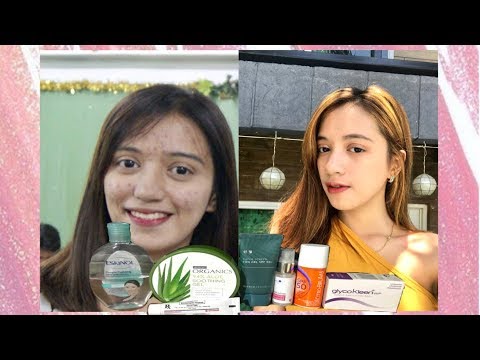 SKIN CARE ROUTINE  Acne prone skin (Philippines) || Jacqueline Juinio