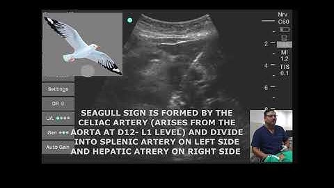 ULTRASOUND GUIDED CELIAC PLEXUS BLOCK USG (ULTRASOUND GUIDED)