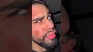 Chad Destroys Bad #shorts #motivation
