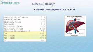 Nutrition For Your Liver: Using A Blood Test, Food & Nutrients Nutrition For Your Liver: Using A Blood Test, Food & Nutrients