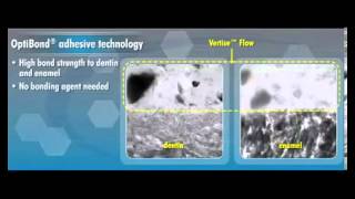 Henry Schein - Kerr Vertise Flow