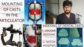 Mounting of master cast on articulator | indexing | complete denture making part 3 | Funowledge