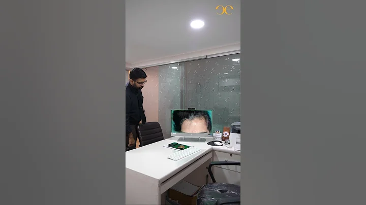 Scar Revision Transition | Accident Scars