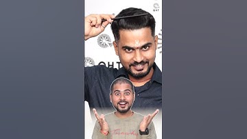 Best Hair Transplant Results | Latest Fue Technique #shorts #viral #hair transplant