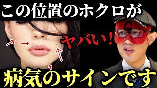 【ゲッターズ飯田】※●●のホクロは全部除去して運勢を変えて下さい！実は顔のほくろの位置で体の不調が分かります…。「手のホクロと金運の関係性　黒子の悩み　2023年の運勢　五星三心占い」