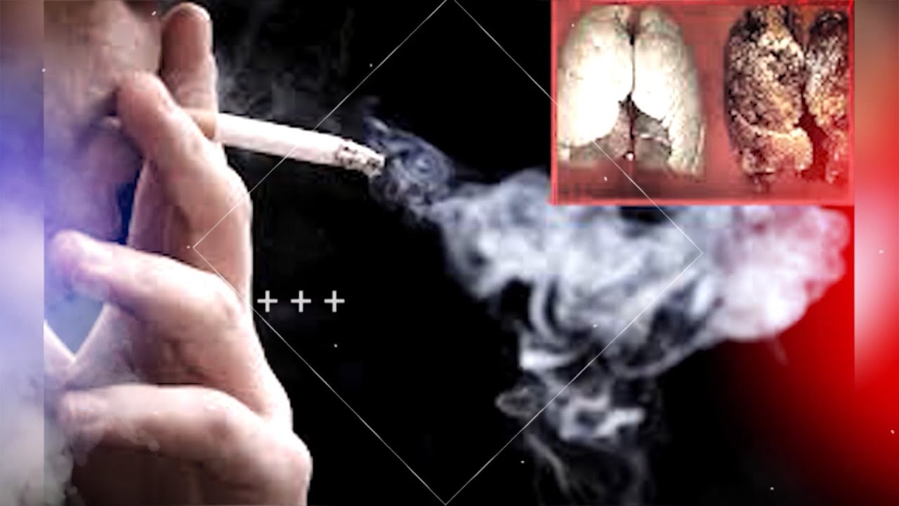 Cai nghiện thuốc lá