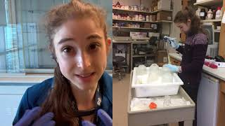 Harvesting cell culture - basics and practical tips