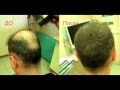 Как работает загуститель волос Hair-Tek.Любительское видео.Выпуск №1