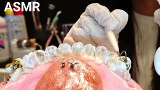 【ASMR】 บทบาทของทันตกรรม ✨ ฟันที่หลุดแล้ววิบวับเปลี่ยนเป็นฟันเทียมกันเถอะ