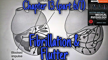 Ventricular fibrillation - chapter 13 (part 6/7) - Guyton and Hall text book of physiology.