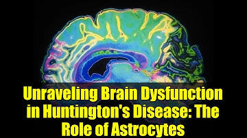 Unraveling Brain Dysfunction in Huntington