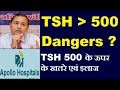 Very High TSH Thyroid Causes Harms Is it Any Serious Howw to Treat Severe Hypothyroid Dr B K ROY