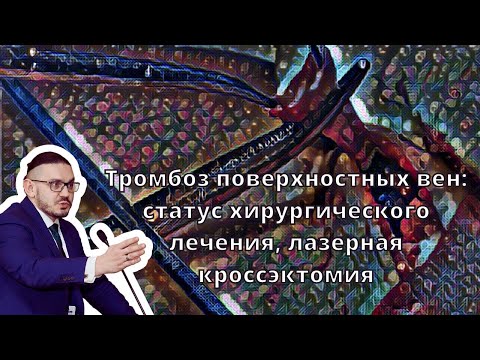 Видеолекция 'Тромбоз поверхностных