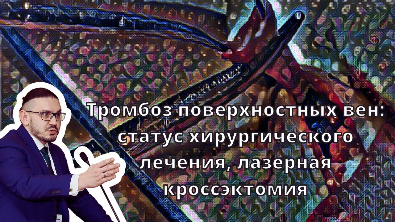 Видеолекция "Тромбоз поверхностных вен: статус хирургического лечения, лазерная кроссэктомия"