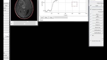 BII AsanJ DCE model free analysis module