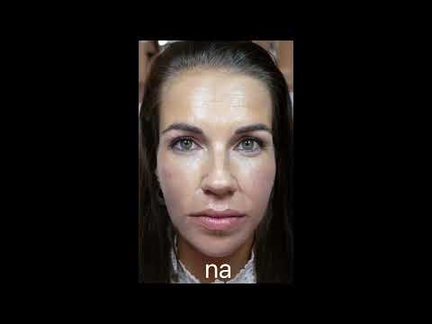 Hyaluronzuur