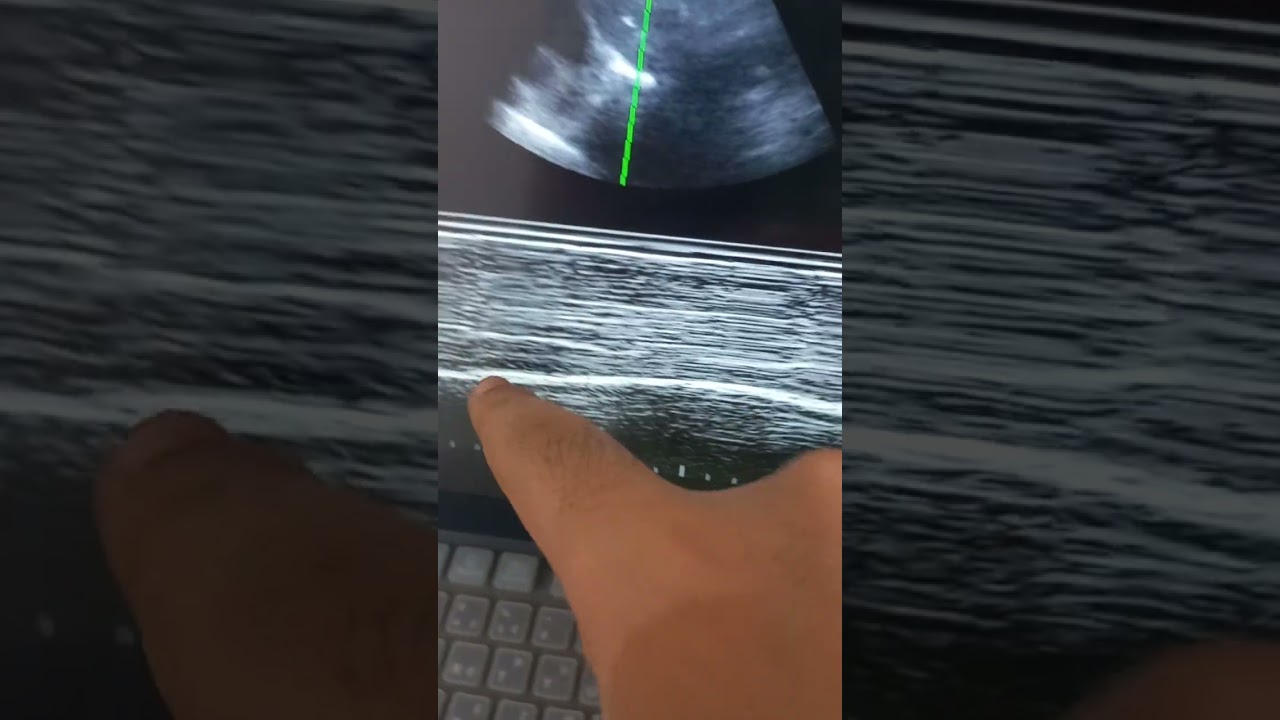سونار العيادة. 4