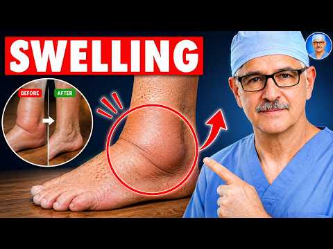 Video Surgeon Reveals: The ONLY 5 Simple Movements to Eliminate Swollen Legs and Ankles | Senior Health