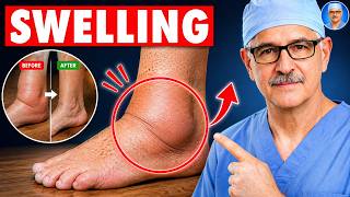 Surgeon Reveals: The ONLY 5 Simple Movements to Eliminate Swollen Legs and Ankles | Senior Health