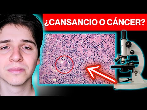 NEOPLASIA MIELOPROLIFERATIVA CRÓNICA ► ENTIÉNDELO AHORA con el RESUMEN de los DIOSES en 8 MINUTOS 😲😲