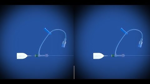 Arrow® NaviCurve Stylet Virtual Reality Video (Goggles Required)