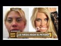 ¿Las famosas abusan del Photoshop?