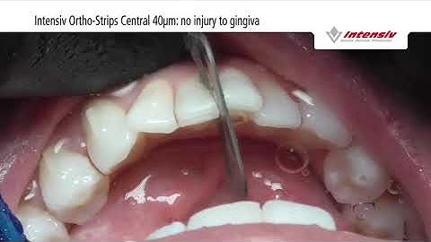 Perform IPR with Intensiv Swingle