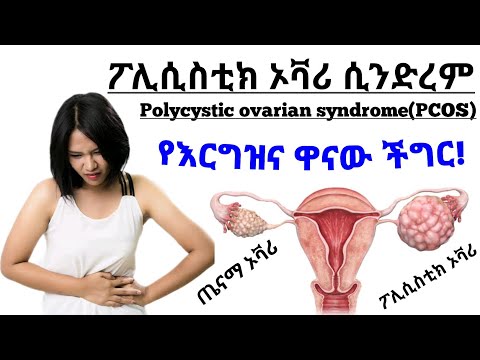 ቪዲዮ: የሚከሰቱ ጉዳቶች ግብር የሚከፈልባቸው ናቸው?