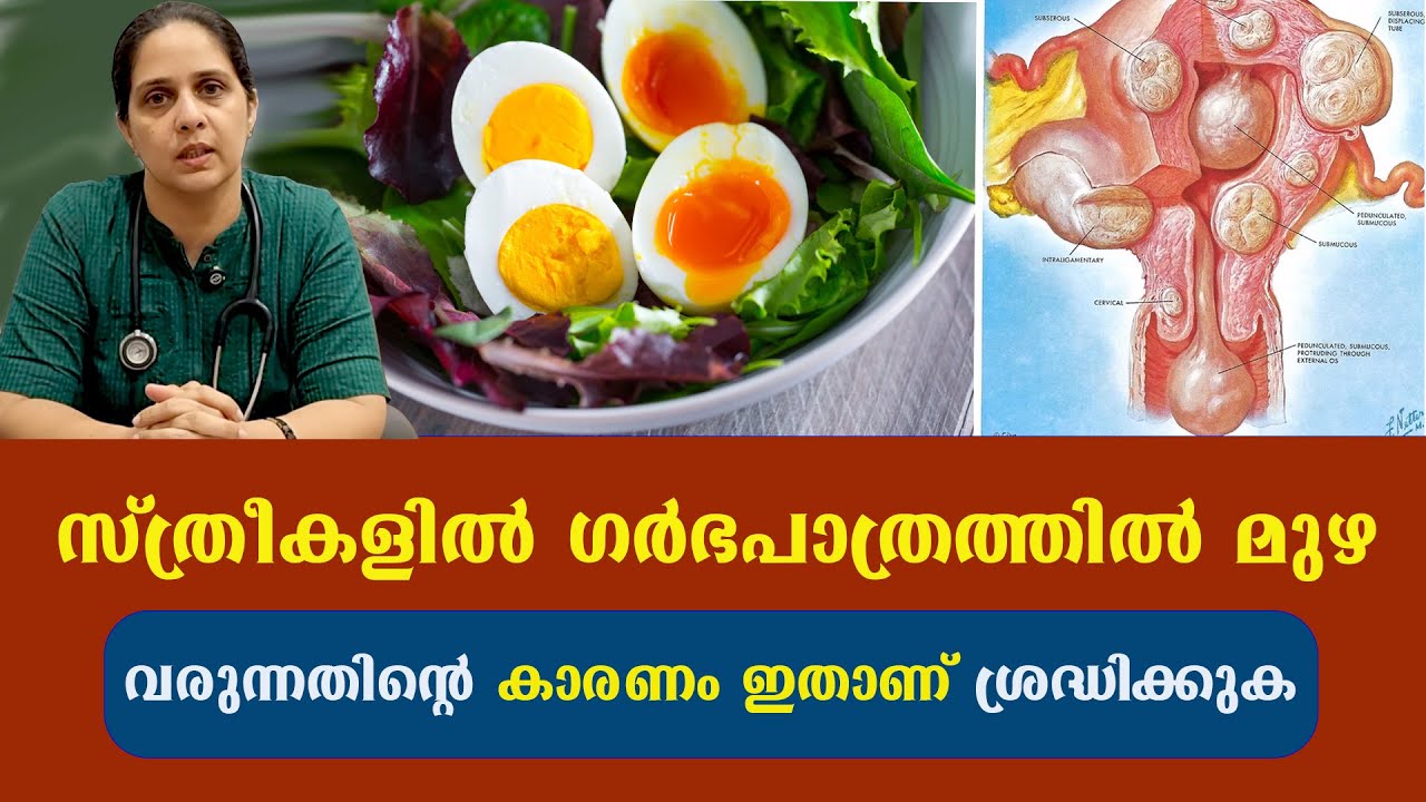 വീട്ടിലുള്ള എല്ലാ സ്ത്രീകൾക്കും പറഞ്ഞു കൊടുക്കേണ്ട ജീവന്റെ വിലയുള്ള അറിവ് Uterine Fibroids