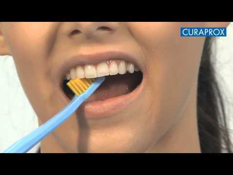 Video: Zobna čiščenja Brez Anestezije