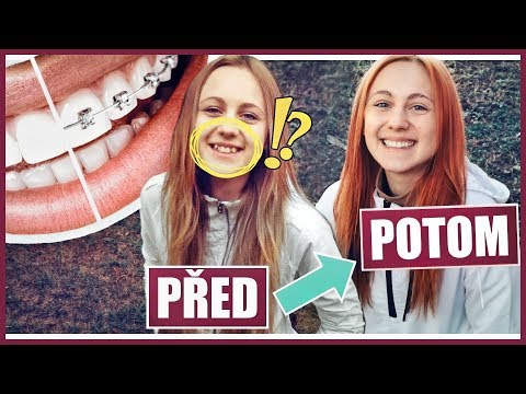 Video: Anglická Rosnatka