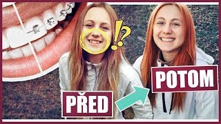 Po 5 LETECH BEZ ROVNÁTEK | Natyla