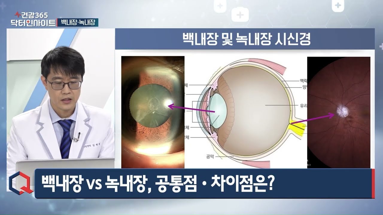 백내장·녹내장 치료 | 이데일리 방송 | 부산 서면성모안과 김태원 원장