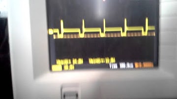 solid state bedini motor ssg without the rotor