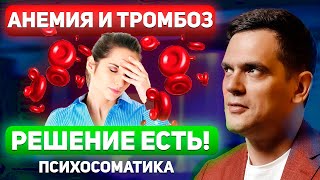 Забудь Про АНЕМИЮ и ТРОМБОЗ. Как УБРАТЬ СИМПТОМЫ Через ПСИХОСОМАТИКУ