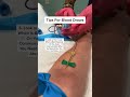 2 vials in less than 1 minute