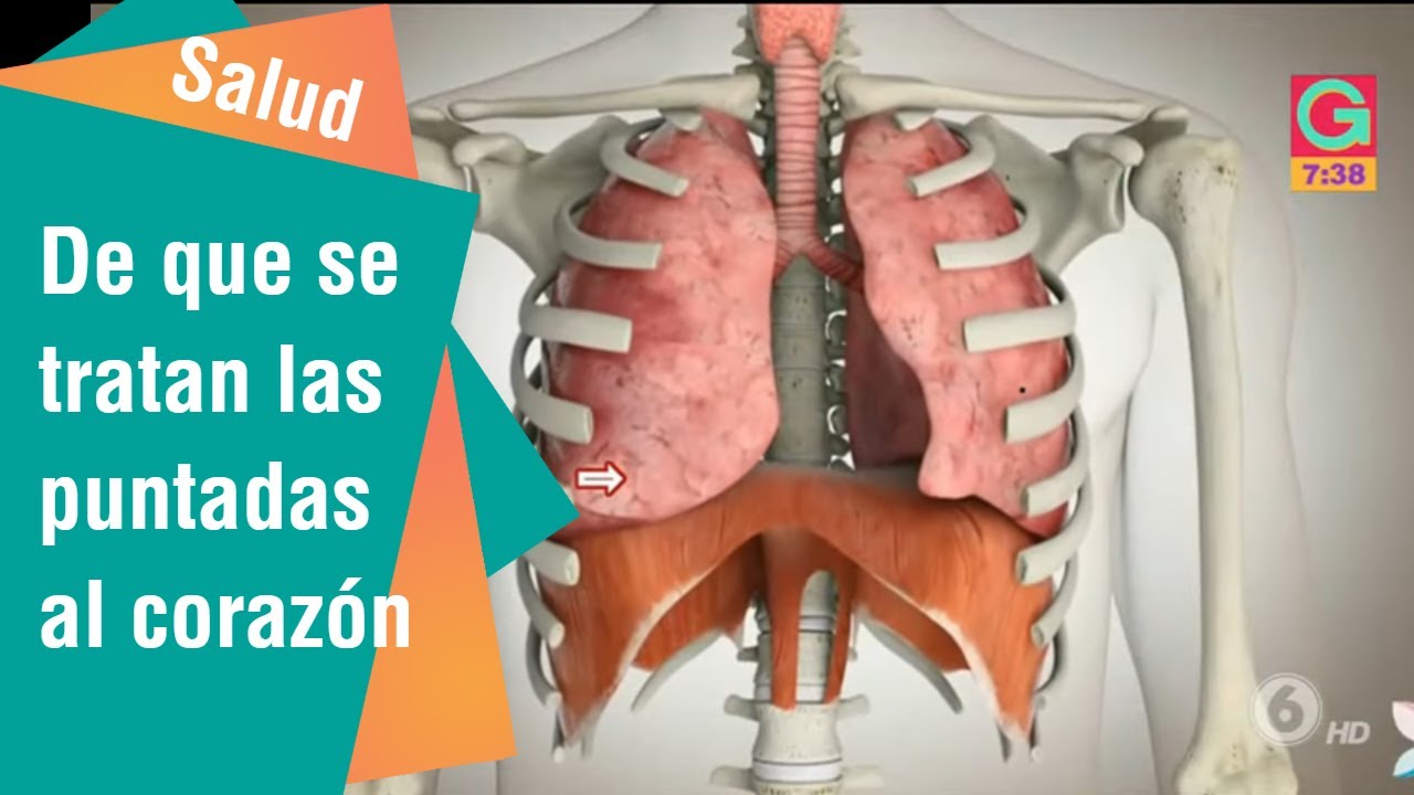 que es cuando da punzadas linear unit el corazon