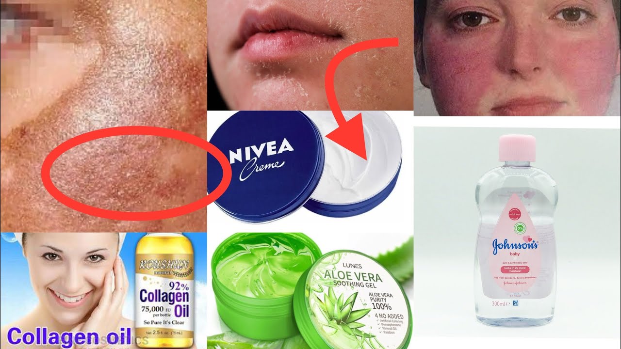 U uxlab yotganida uning oyogiga silkinib tushadi.