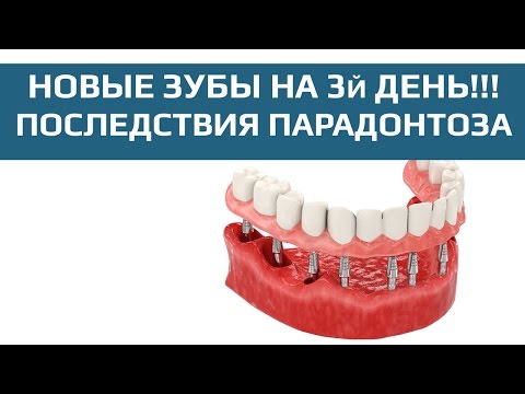 Имплантация с немедленной