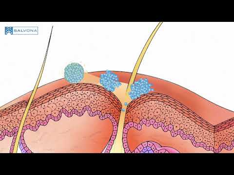 Video: Sebum: Mikä Se On, Kuinka Poistaa Ylimääräinen Kasvoista, Hiuksista, Päänahasta, Lisää