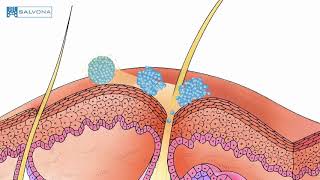 Animation: 8123 - MultiSal Sebum Control