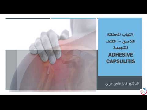 إلتهاب المحفظة اللاصق Adhesive Capsulitis - الكتف المتجمدة - تعريف وإمراضية