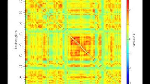 Dynamic functional connectivity