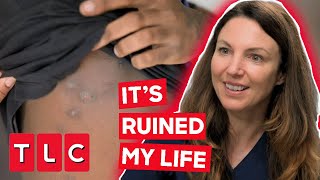Dr. Emma Has To Inject This Patient's Bottom To Stop His Chronic Boils | The Bad Skin Clinic