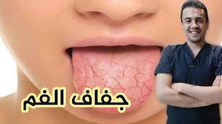 جفاف الفم وأمراض الغدة اللعابية? (أسبابه وطرق العلاج)